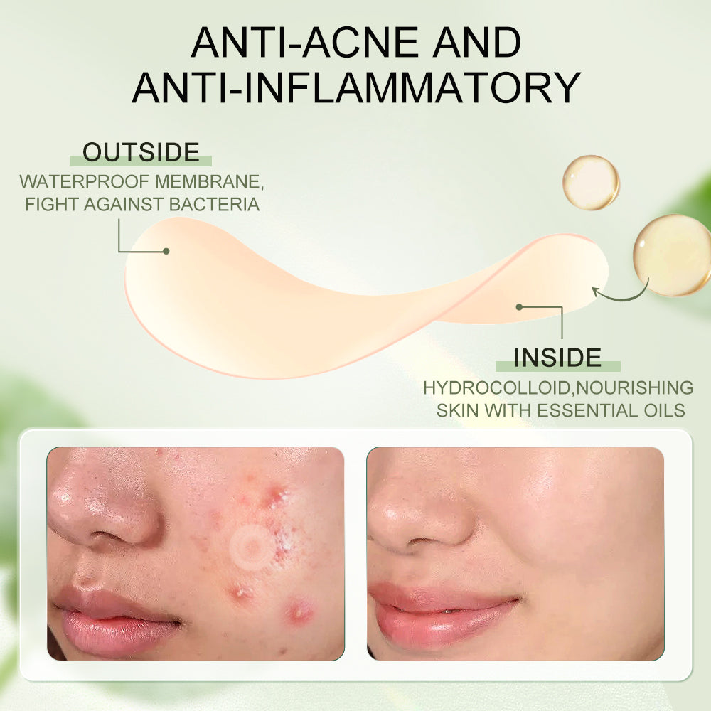 Waterproof Invisible Acne Patches – 36 Patches