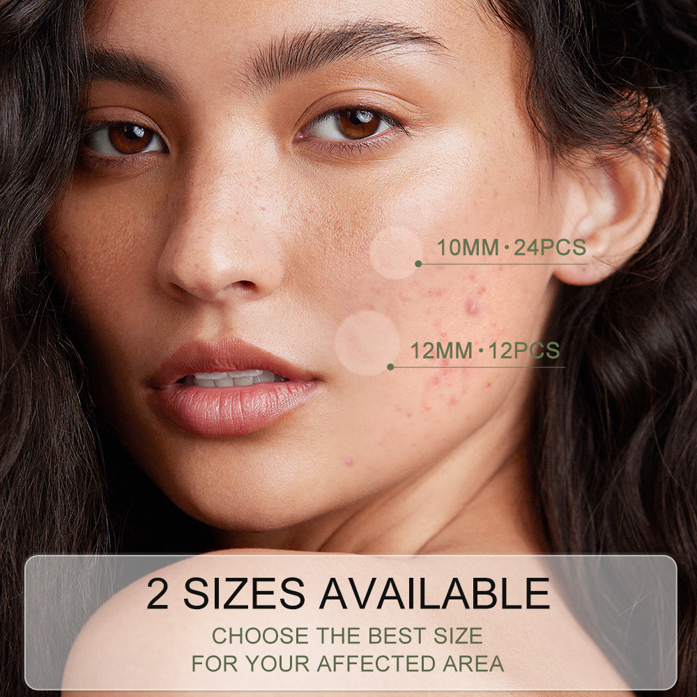 Waterproof Invisible Acne Patches – 36 Patches